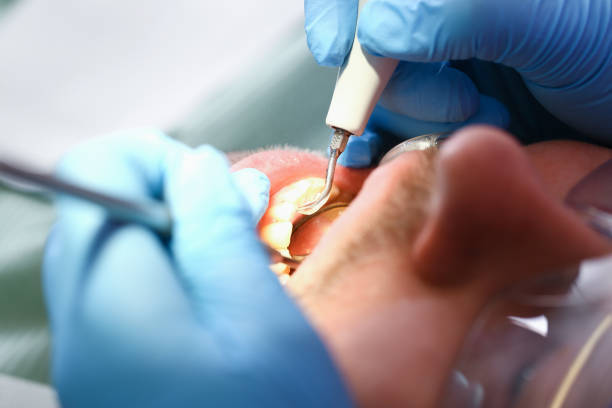Best Emergency Gum Pain Relief  in Graham, TX